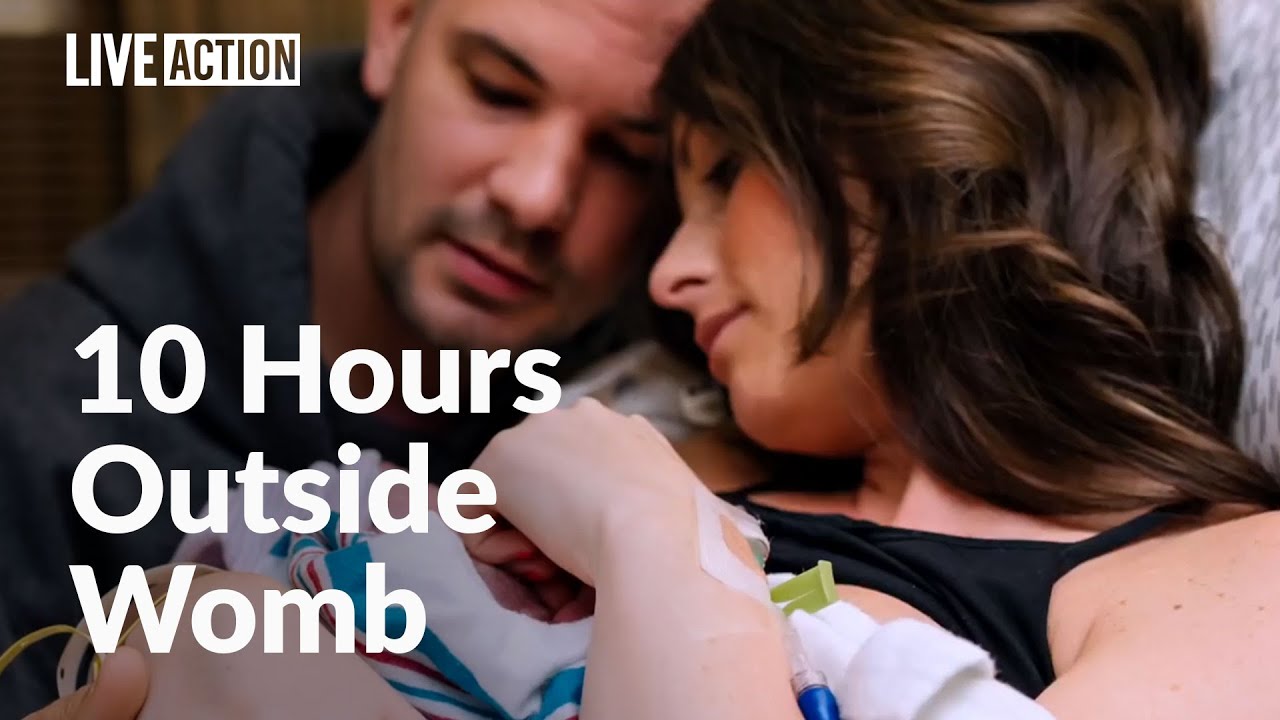 Parents love and care for daughter with anencephaly - 