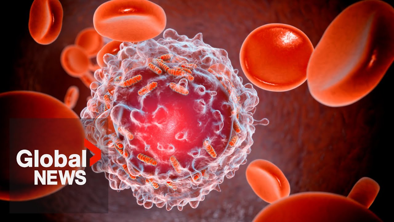 WHO predicts global cancer rates will rise more than 75% by 2050