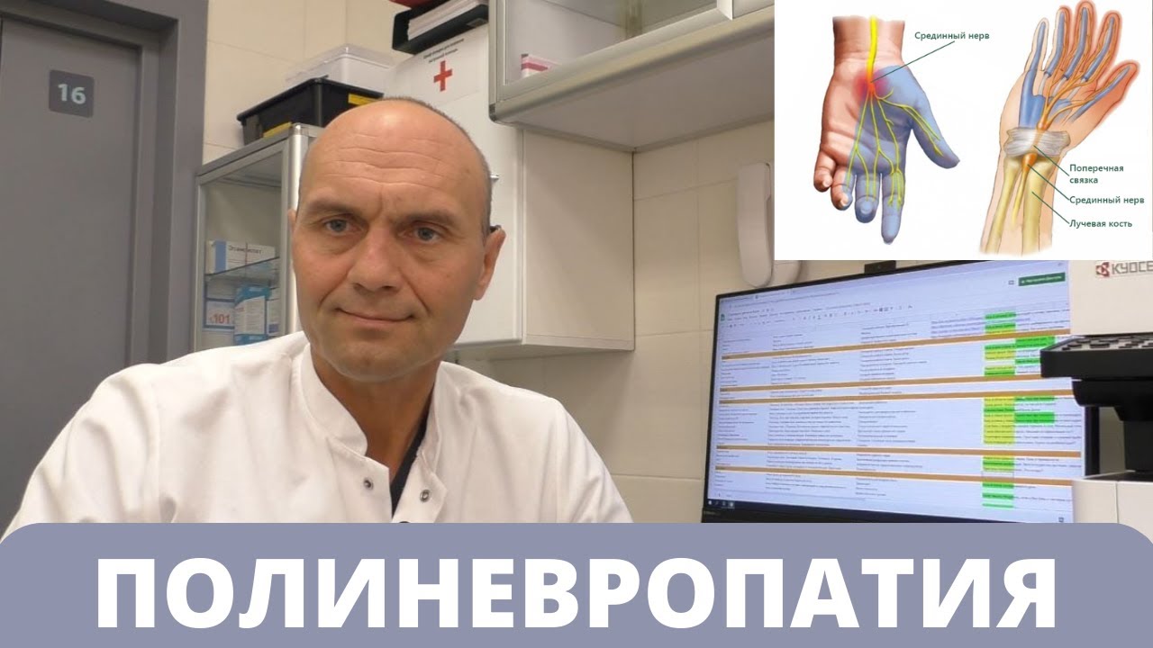 ПОЛИНЕВРОПАТИЯ: диагностика, рекомендации по лечению