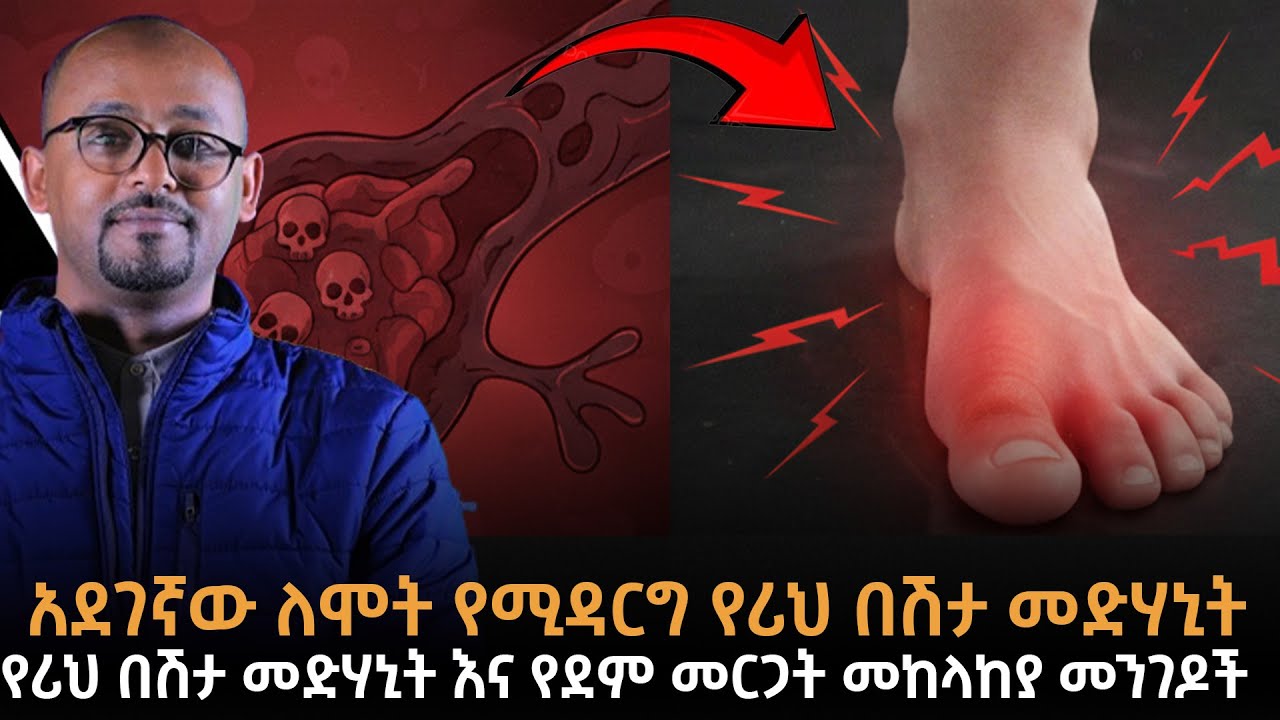 ማስጠንቀቂያ! የሪህ በሽታ እና የደም መርጋት በድንገት የሚያመጡት አደጋ |የሪህ በሽታ መድሃኒት ከመጀመርዎ በፊት ይህን የግድ ይዩ!|ራፋቱኤል|Taza