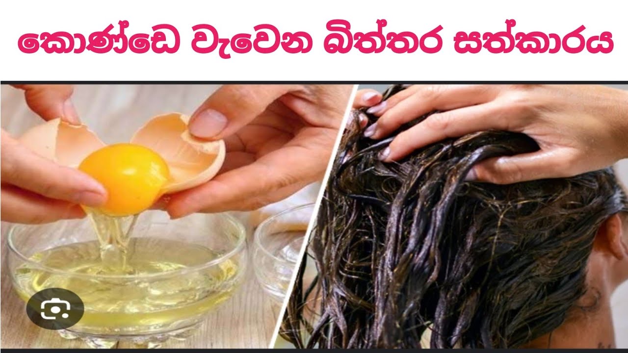 කොණ්ඩෙ වැවෙන බිත්තර සත්කාරය/hair growth tips - Sinhala
