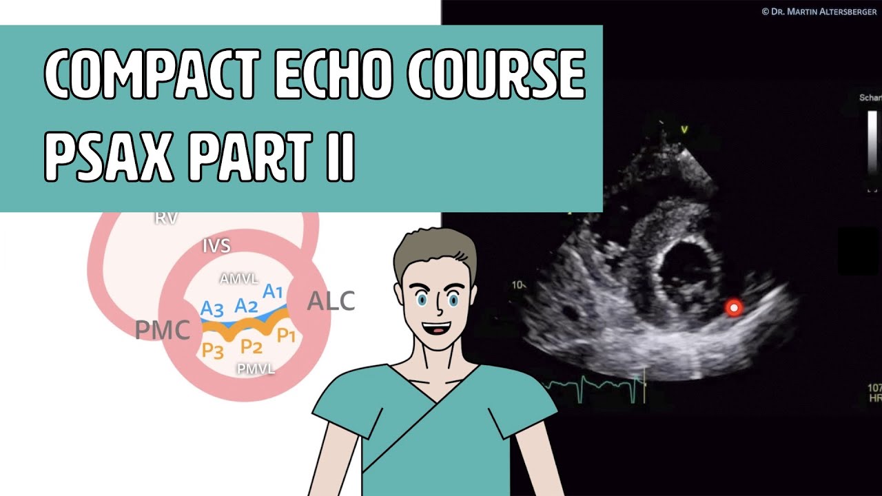 〖Echocardiography〗 Parasternal short axis - Anatomy part II (PSAX)