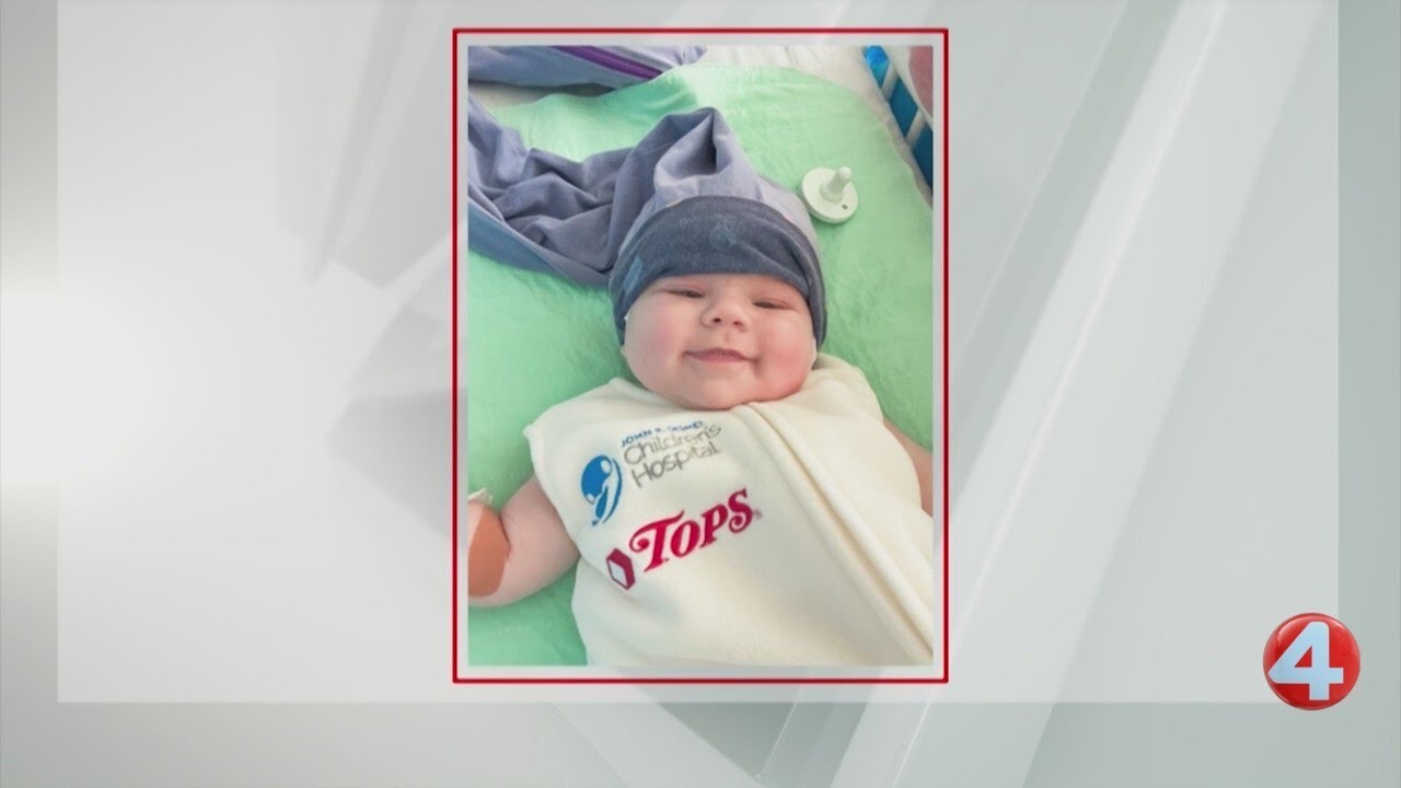 Hamburg family's insurance reversal clears way for baby's life-saving brain surgery