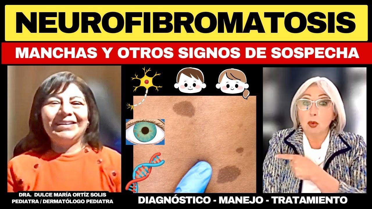 NEUROFIBROMATOSIS. MANCHAS, PECAS, TUMORES y otras SEÑALES CLAVES PARA EL DIAGNÓSTICO. @depielapiel 