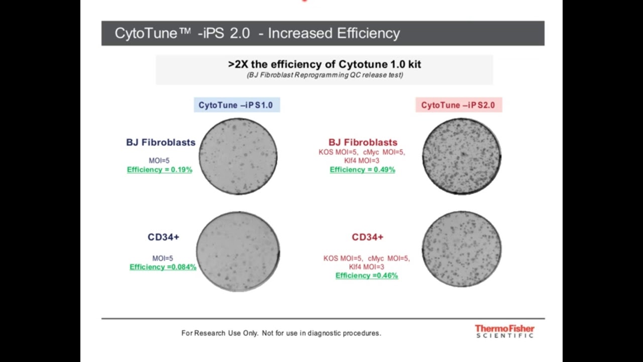 iPSC를 이용한 세포치료 및 질환모델 확립