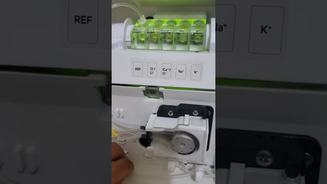 Causes of Opto calibration error on Erma EL-120 ELECTROLYTE ANALYZER
