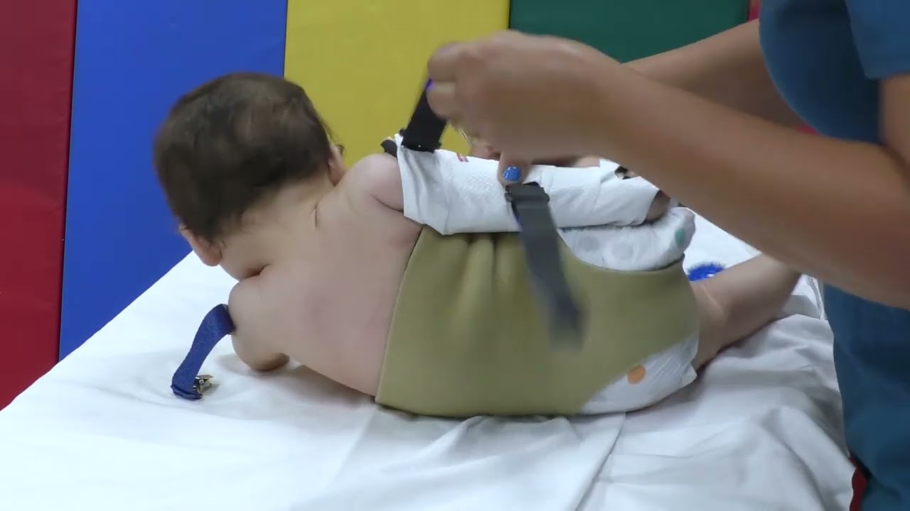 How to Apply a Super Orthosis on Babies with a Brachial Plexus Injury