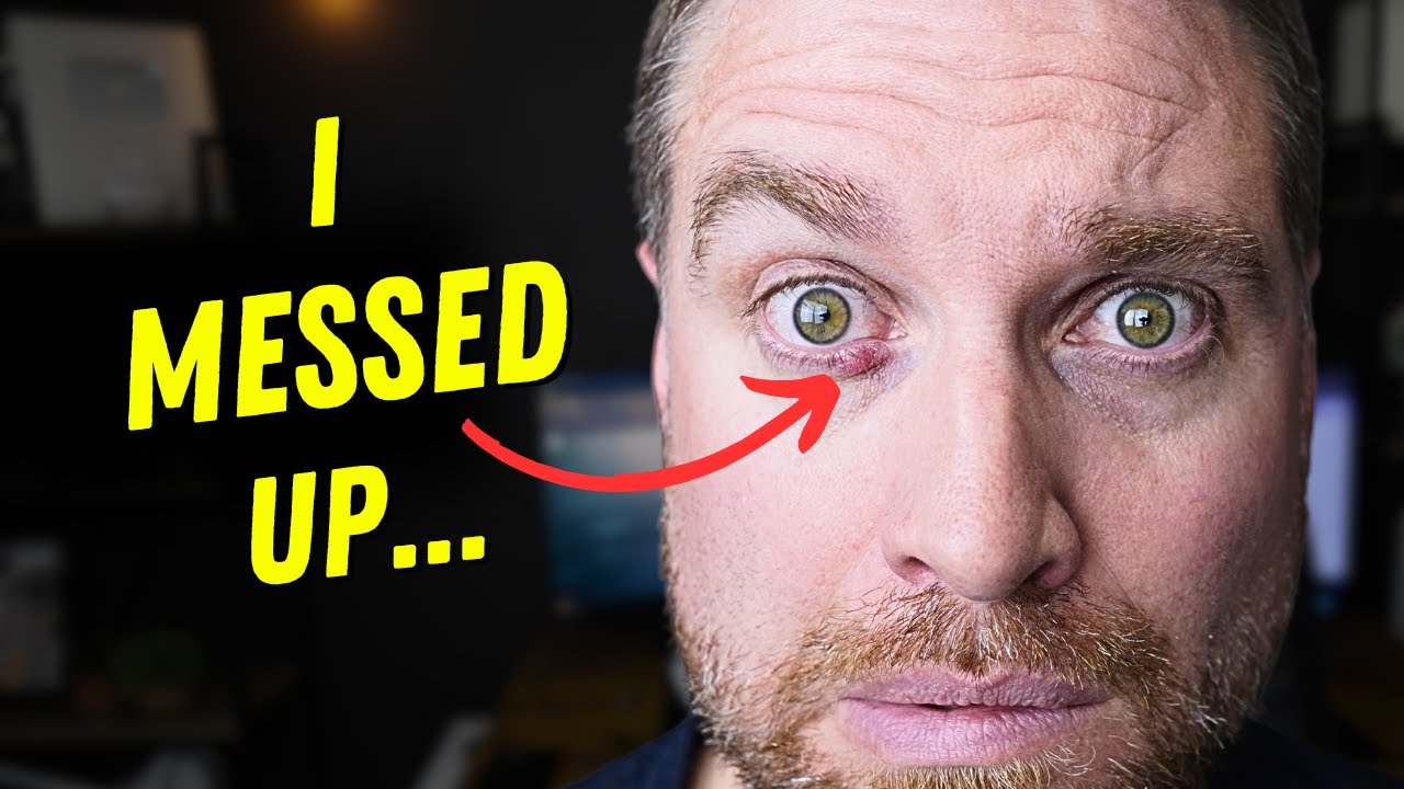 I Stopped My Dry Eye Routine For 30 Days.... Then This Happened.