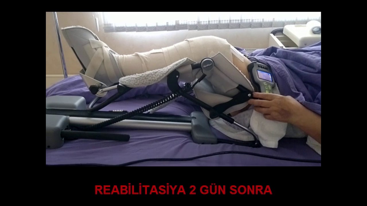 Diz oynağının endoprotezləşməsi.