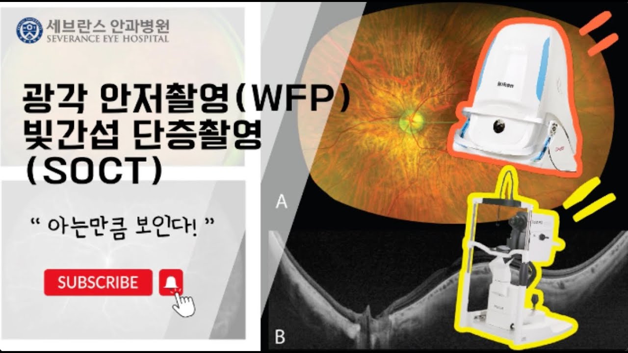 안과 검사 안내영상 - 광각 안저촬영(WFP) 빛간섭 단층촬영(SOCT)