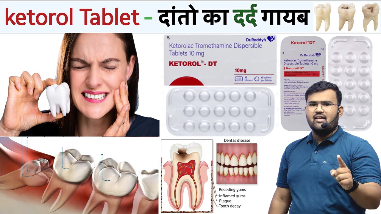 दांतों का दर्द | Ketorol Tablet | Teeth Pain | Painkiller | Painkiller Tablet | Painkiller Medicine 