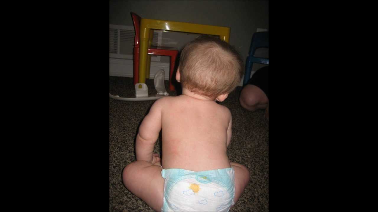 My Torticollis Baby YouTube Channel