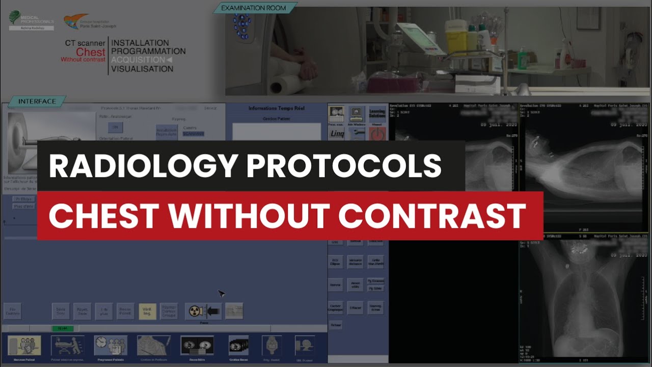 Computed Tomography Protocol Step-by-Step Guide: Chest CT Without Contrast