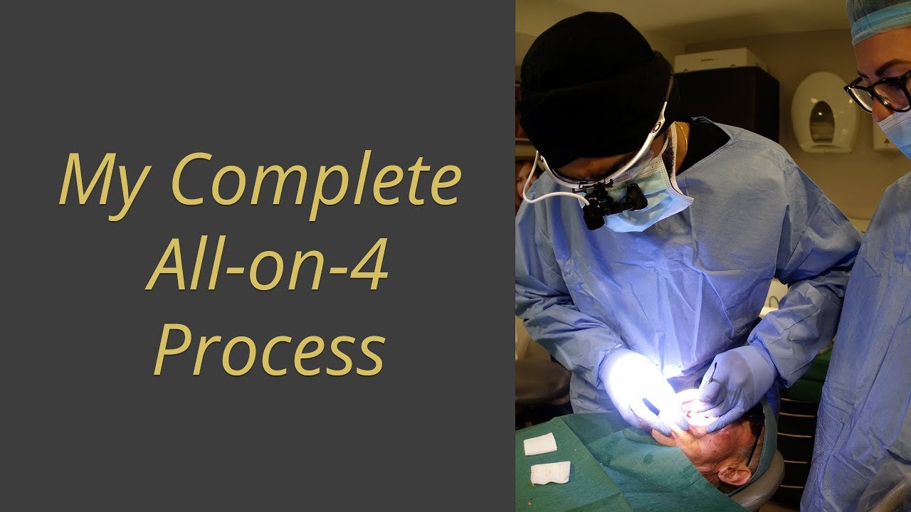 Все на 4 — чего ожидать