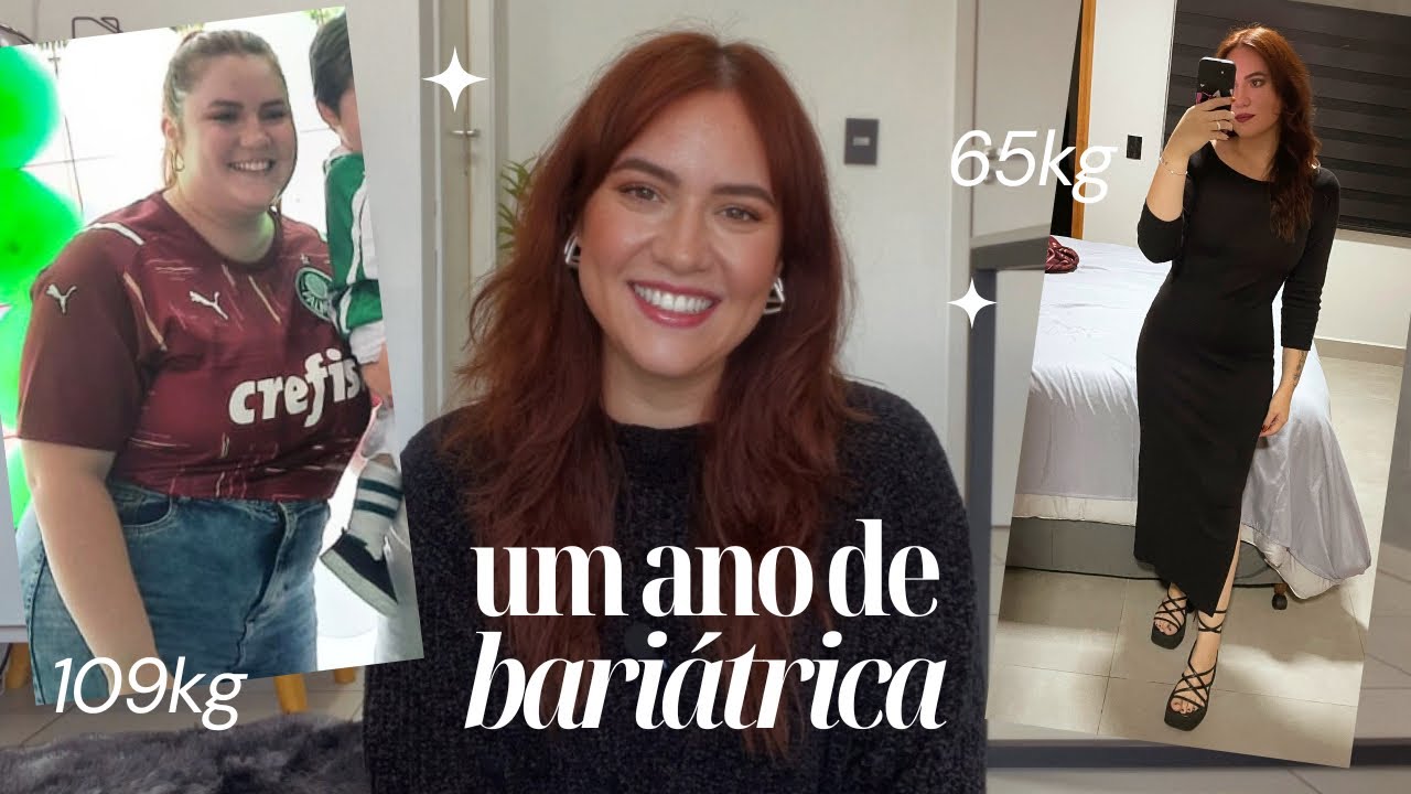 UM ANO DE BARIÁTRICA -44KG E UMA VIDA NOVA | Amanda Paduan