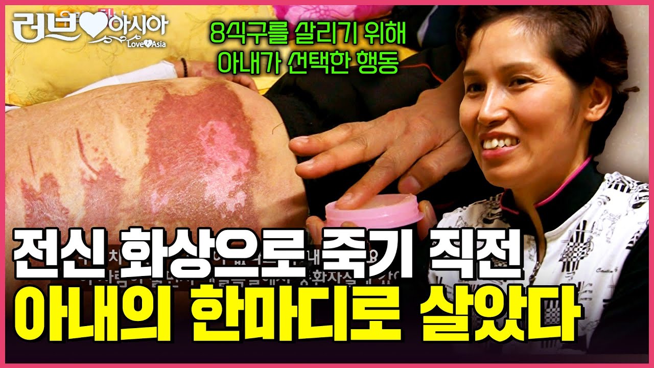 [러브인아시아] 챙길 식구만 무려 7명! 온 몸에 화상을 입은 남편을 대신해 모든 가족을 챙기는 아내의 선택과 사랑ㅣ우리는 하나ㅣKBS 2011.01.28