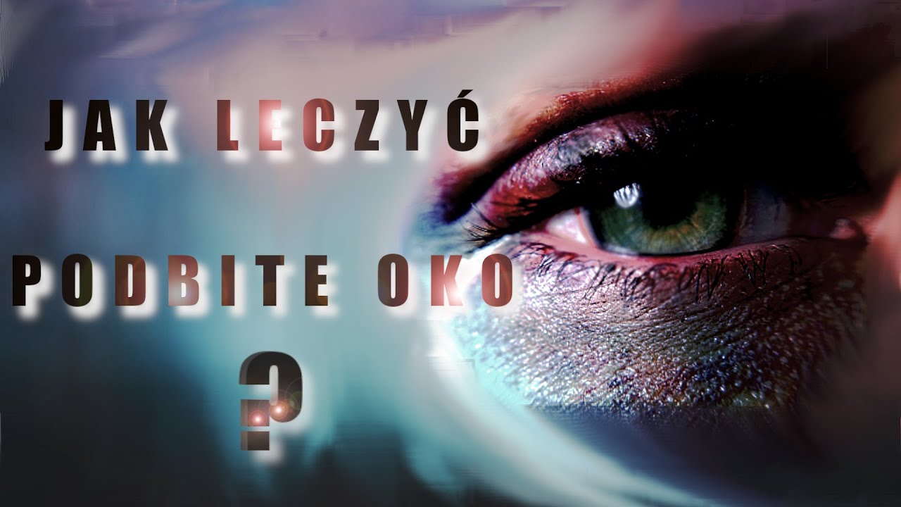 Jak leczyć podbite oko(szybciej)