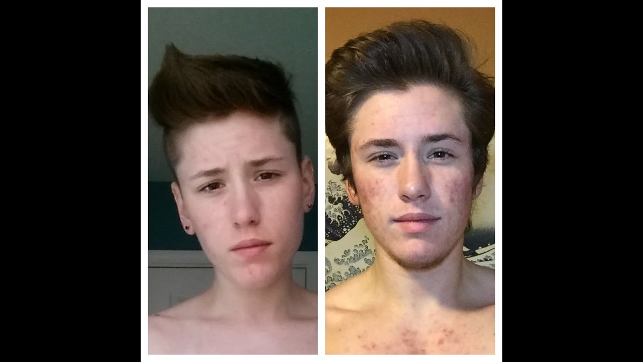 FTM - Pre T to 10 Months