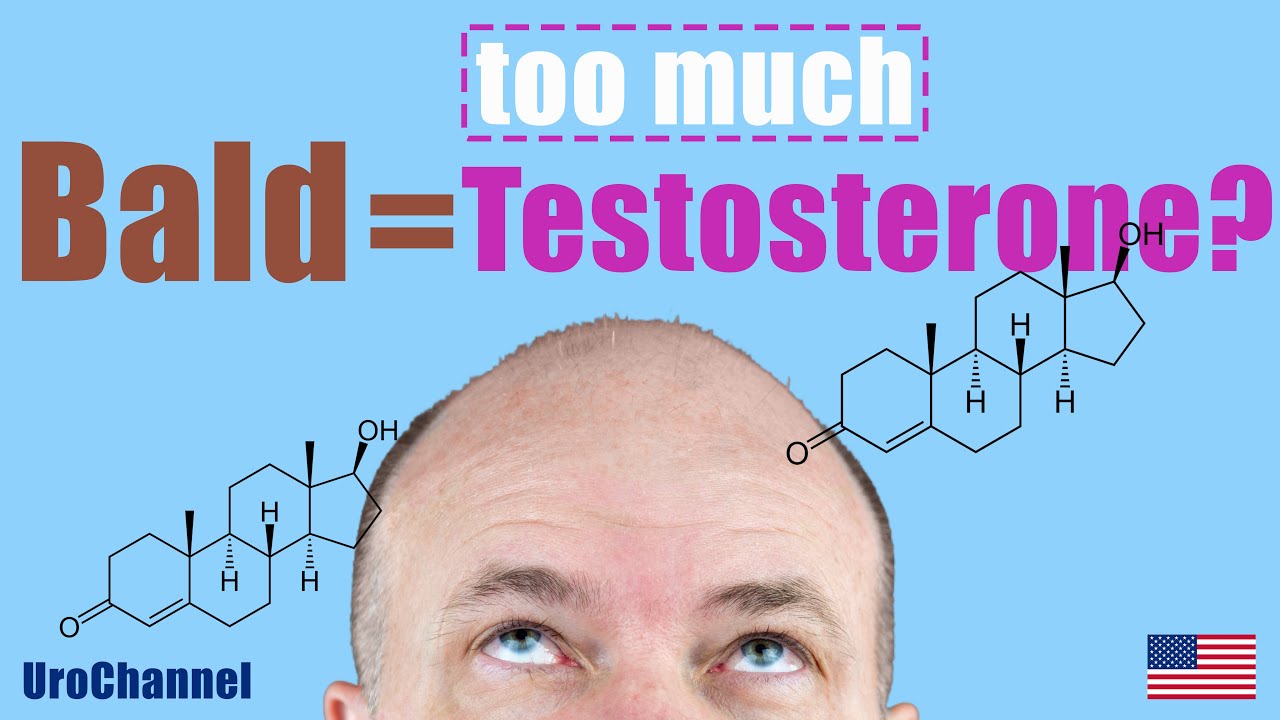 Do bald men have more testosterone? | UroChannel