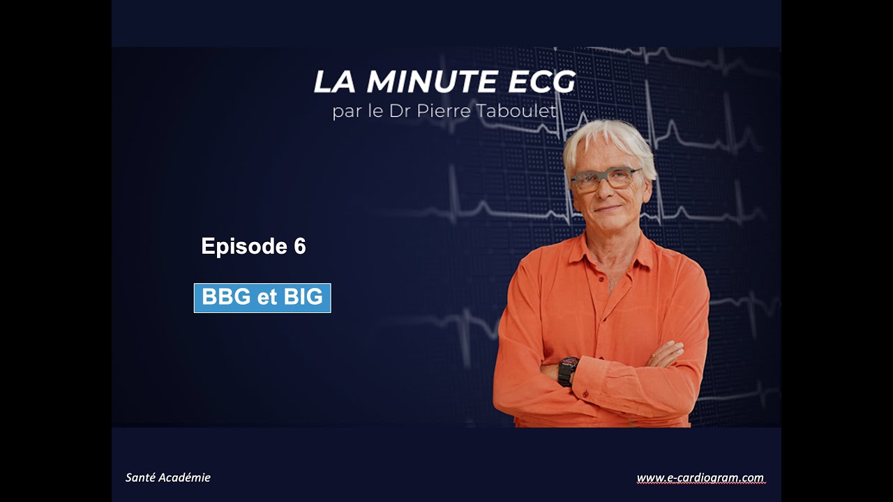 ECG minute 6. Bloc de branche gauche ou bloc incomplet gauche ?