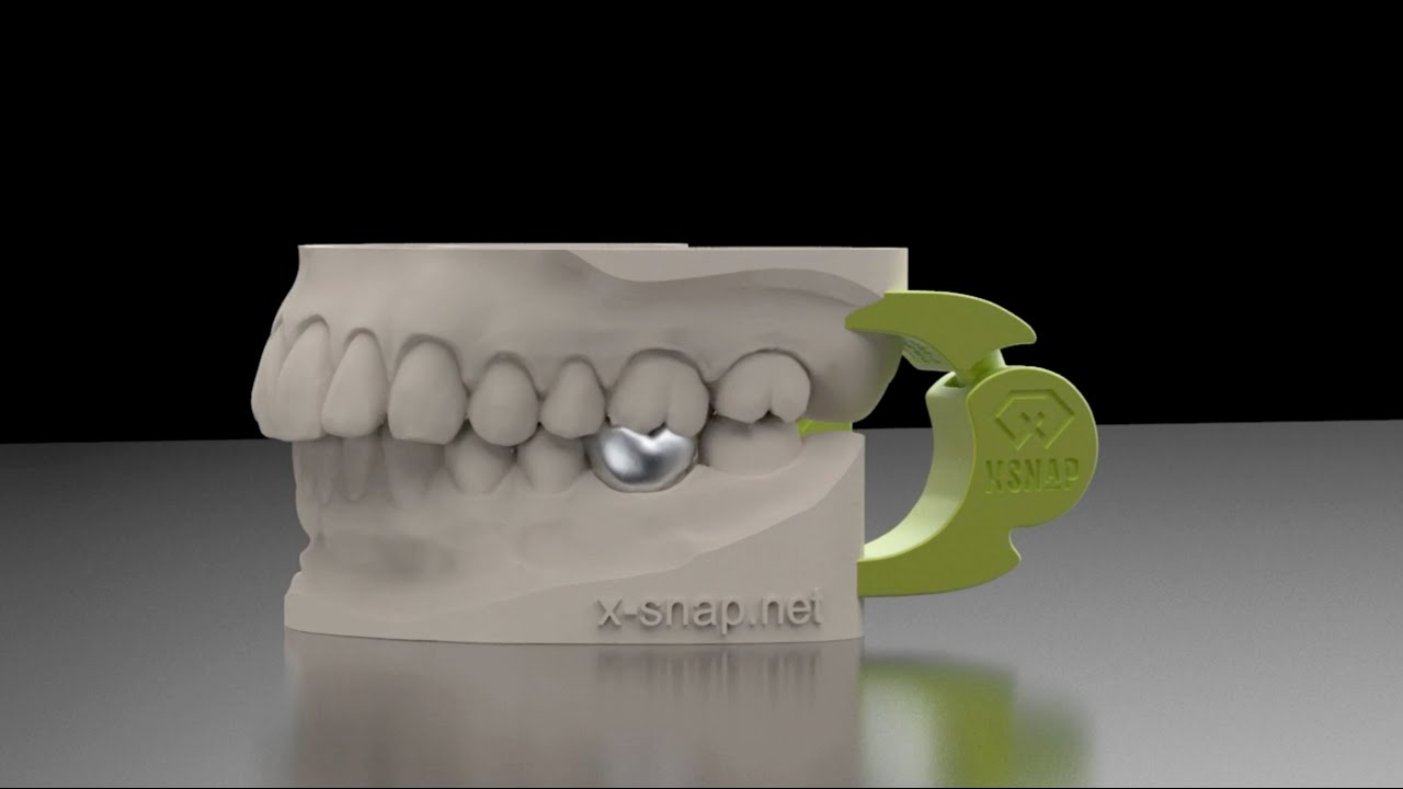 It's time for dynamic 3D occlusion!