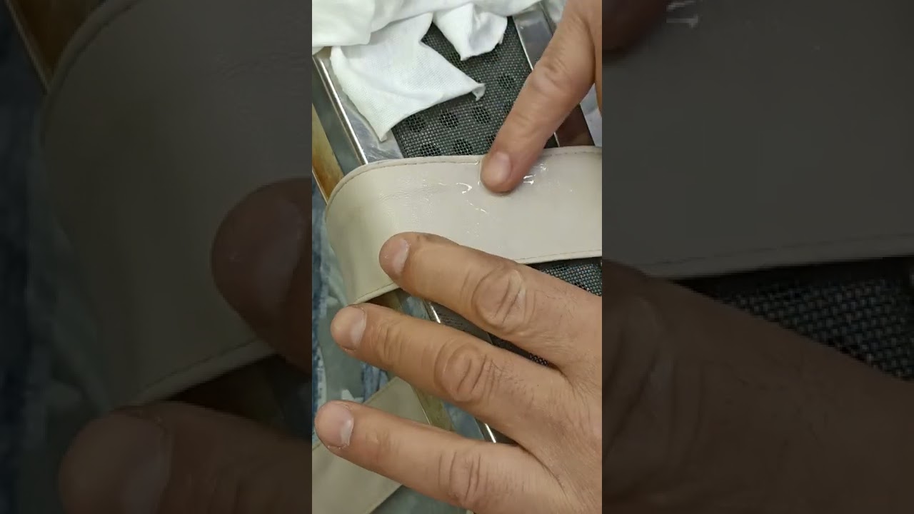 DERİDE M&Uuml;REKKEP. BOYA LEKESİ NASIL &Ccedil;IKAR