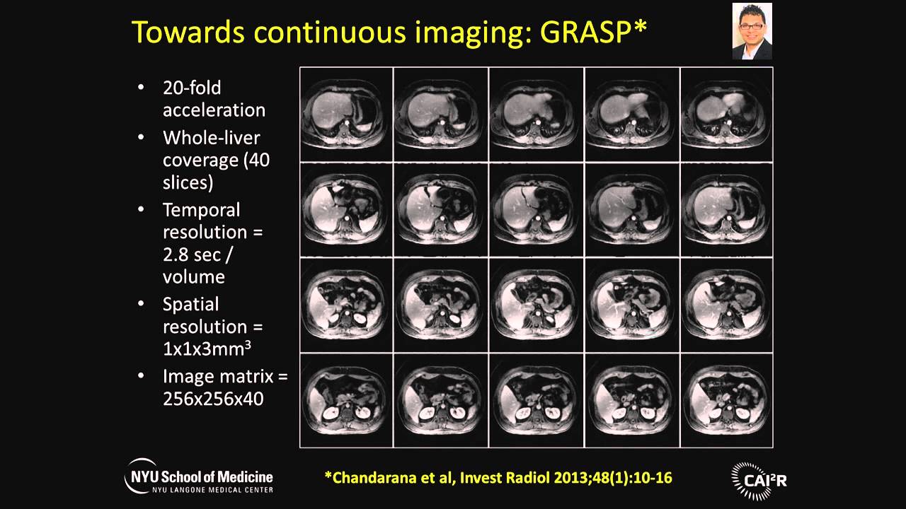 Daniel Sodickson plenary talk: The Rapid Imaging Renaissance