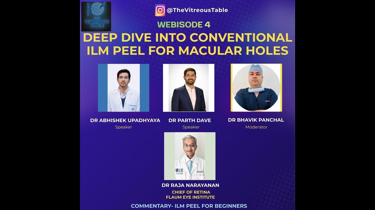The Vitreous Table Webisode 4  - Macular hole ILM peeling