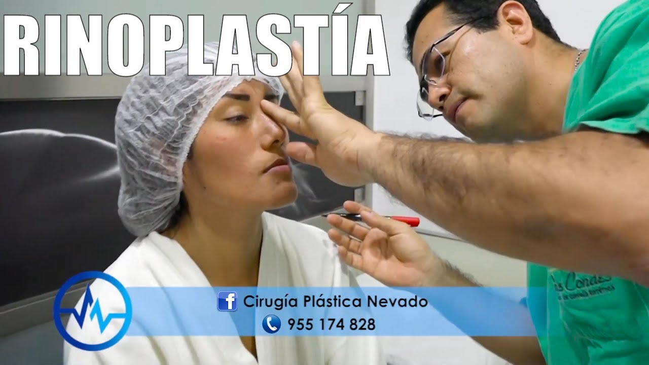 RINOPLASTÍA 👃 CASO de ÉXITO 🤩 Dr PERCY NEVADO ALBÁN ⭐ Cirugía Plástica Nevado
