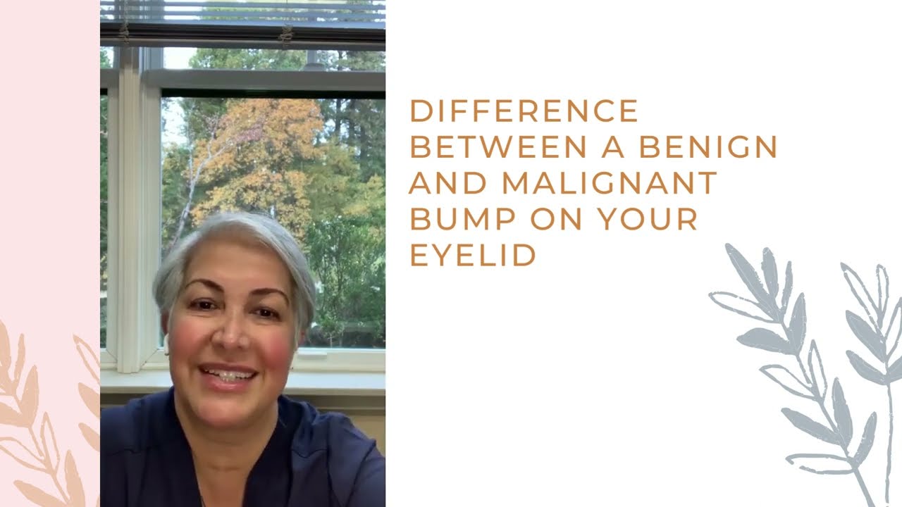 Is the bump on your eyelid benign or malignant? | Dr. Mitra