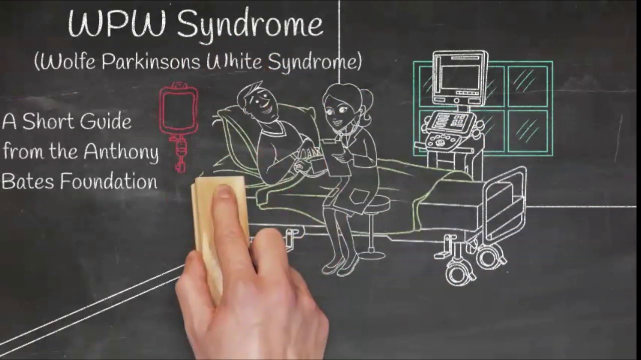 ABF WPW Syndrome - What You Should Know!