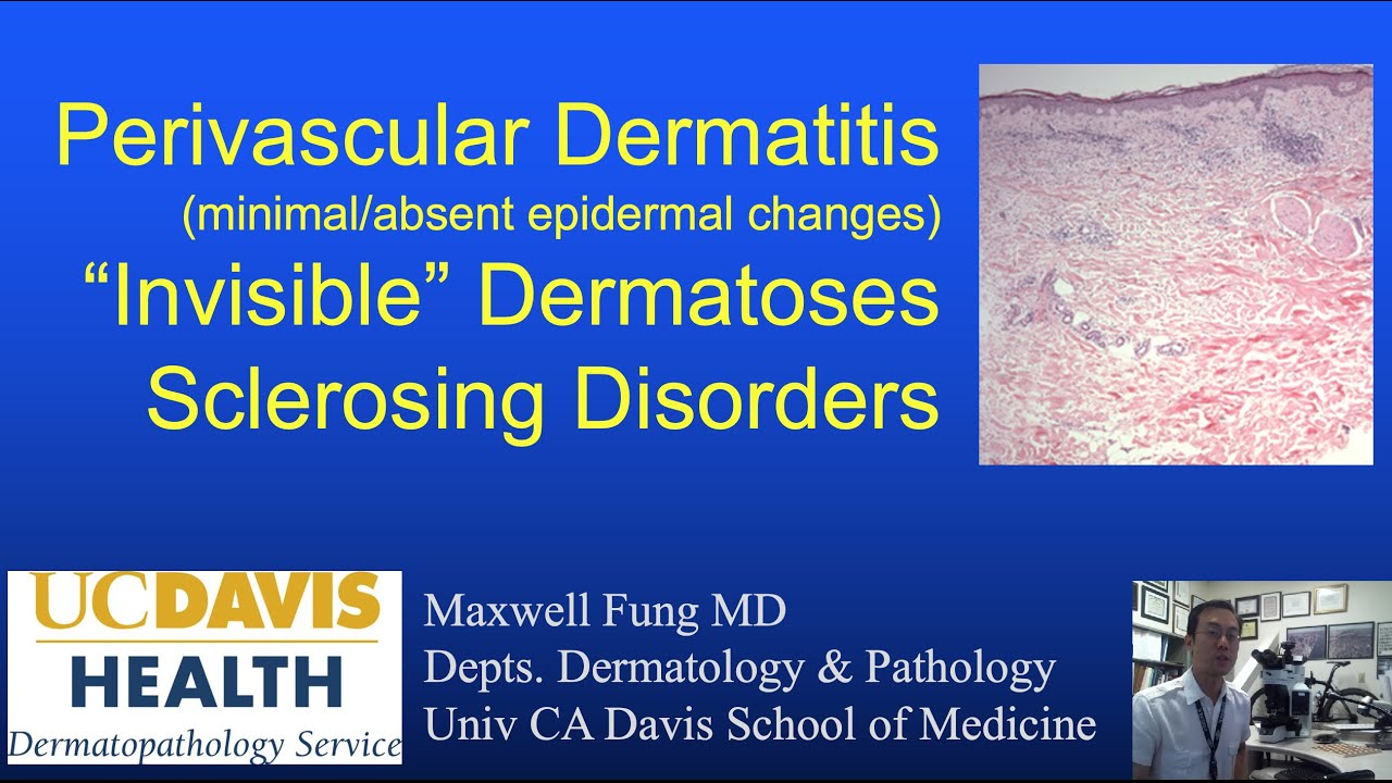 DERMATOPATHOLOGY: Perivascular Dermatitis, Invisible Dermatoses, Fibrosing &  Sclerosing Disorders
