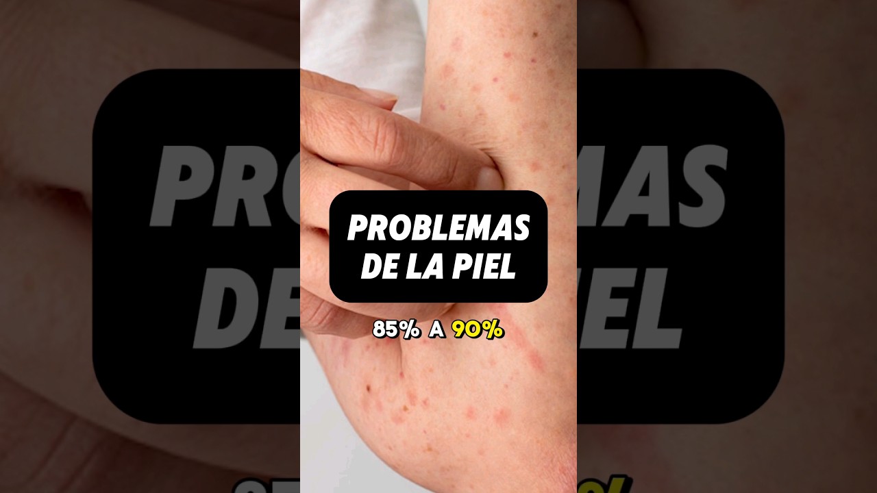 &iquest;Tienes problemas de la piel? #salud #piel #psoriasis #dermatologia #higado #emociones