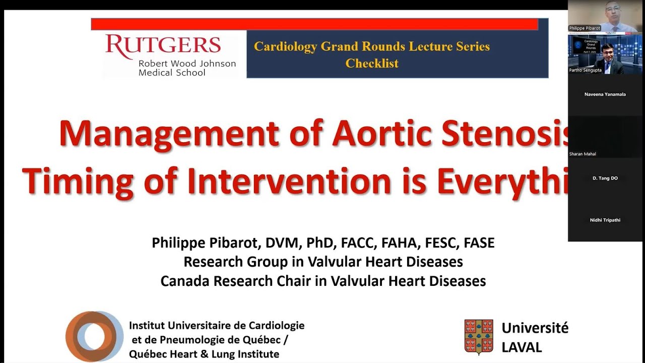 Management of Aortic Stenosis: Timing of Intervention is Everything