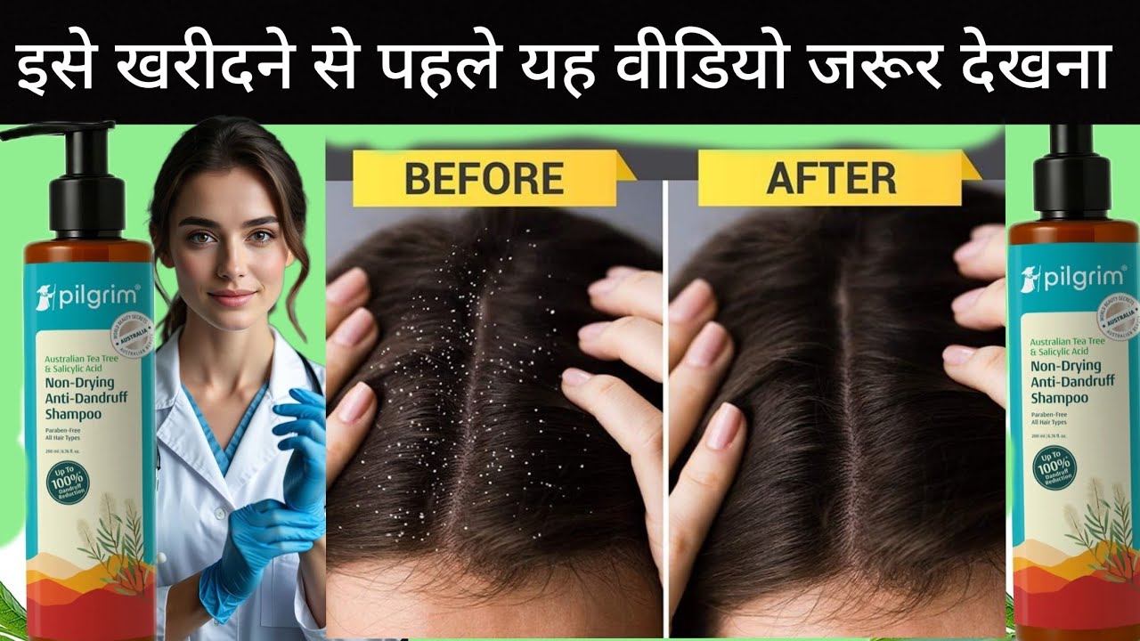 Pilgrim Anti-Dandruff Shampoo Review✨️💯 | Beauty Basic 