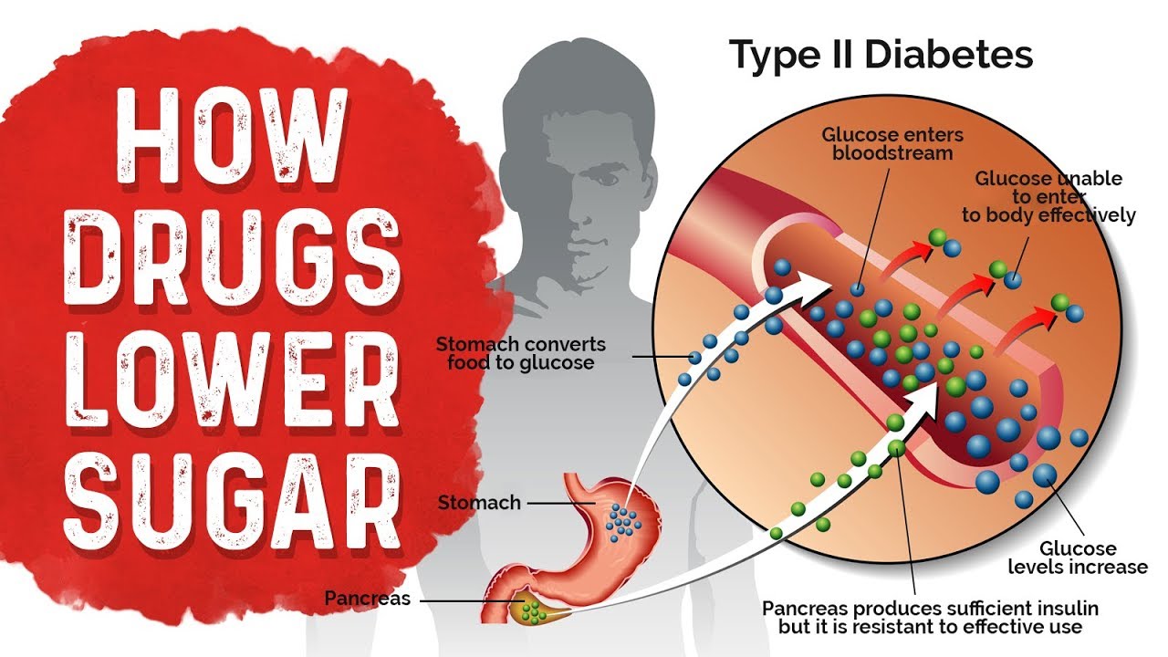 Diabetes Medication Side Effects: Metformin, Sulfonylurea & Insulin – Dr.Berg