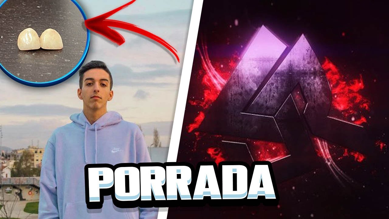 BEEF | EDU SILVA VS REDLIVE (REDLIVE PARTIU OS DENTES A EDU SILVA)