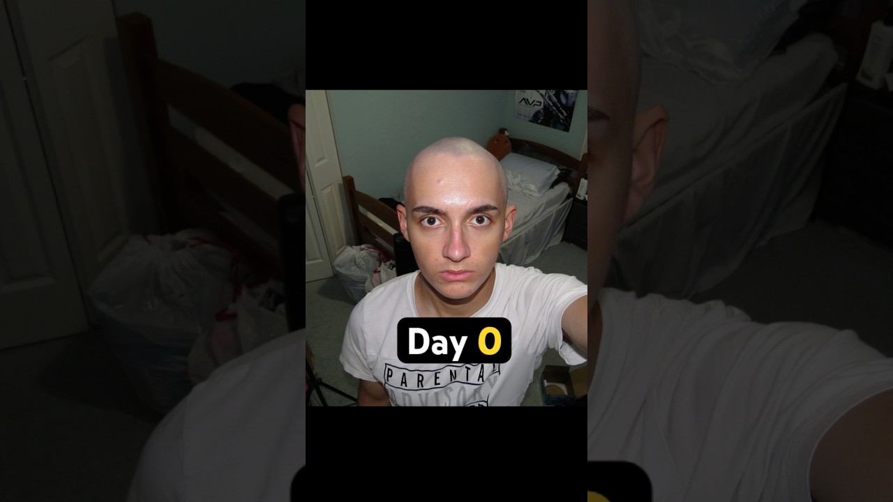 I Took a Picture of Myself Everyday Until My Hair Grew Back #bald #nohair #stopmotion #shorts