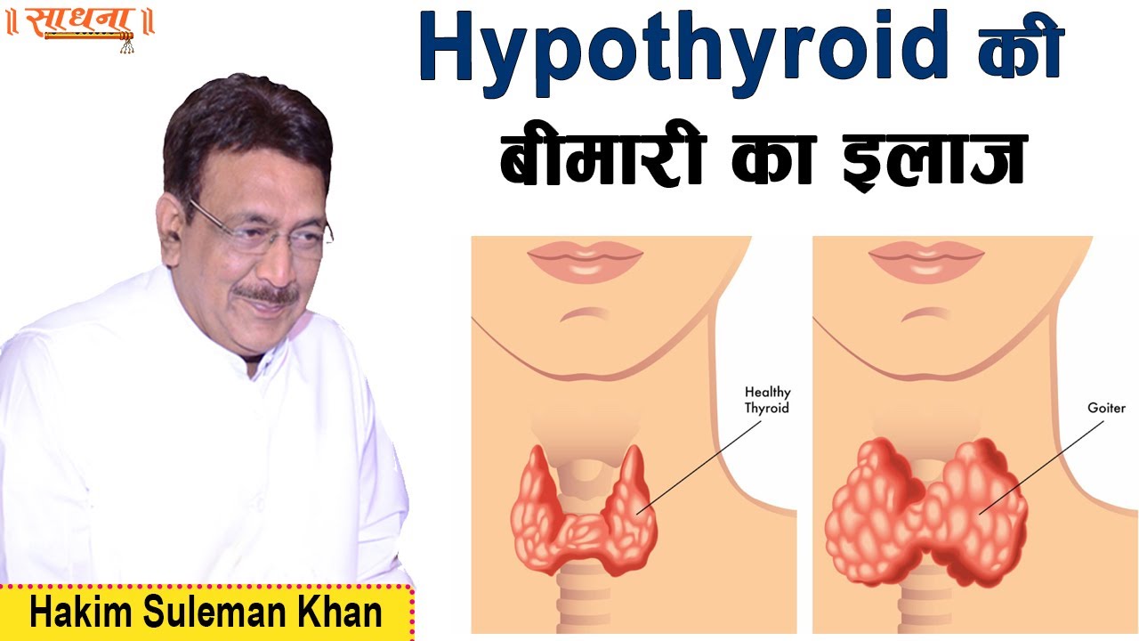 Hypothyroid की बीमारी का इलाज। Hakim Suleman Khan। Sadhna TV
