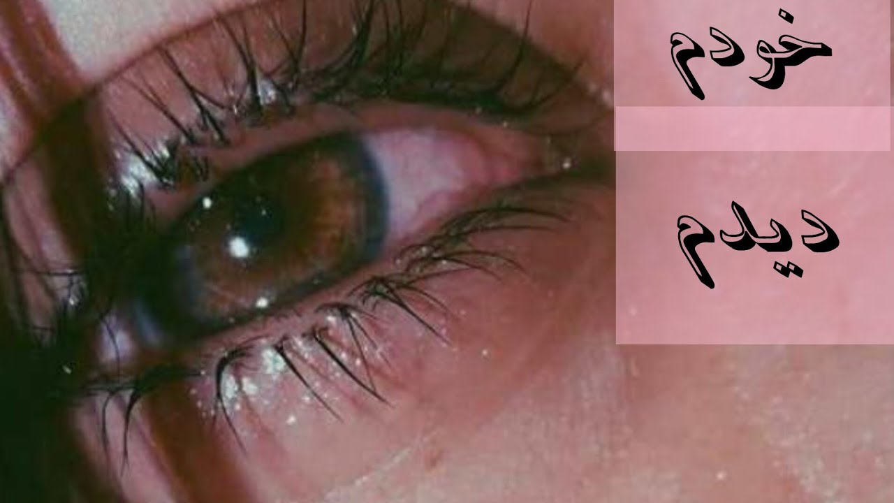 این یک داستان کاملا واقعیه