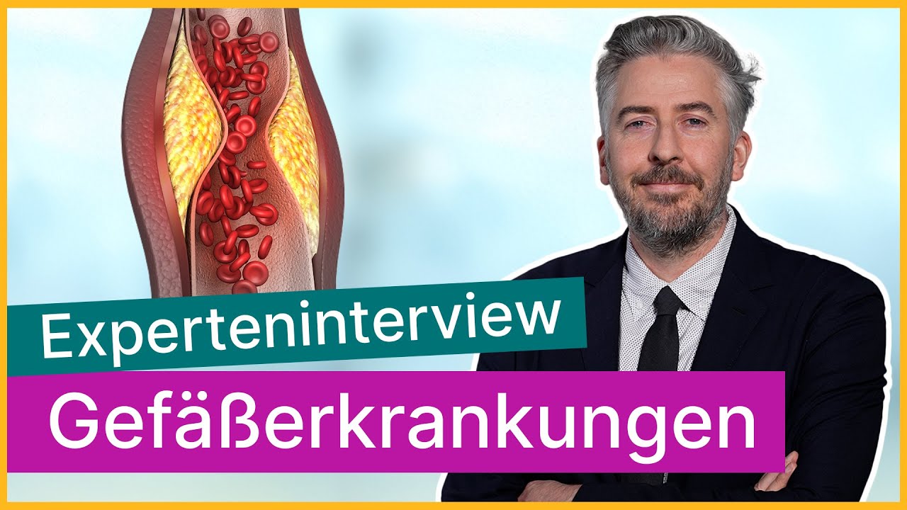 Alles über Gefäßerkrankungen und ihre Behandlung | Asklepios