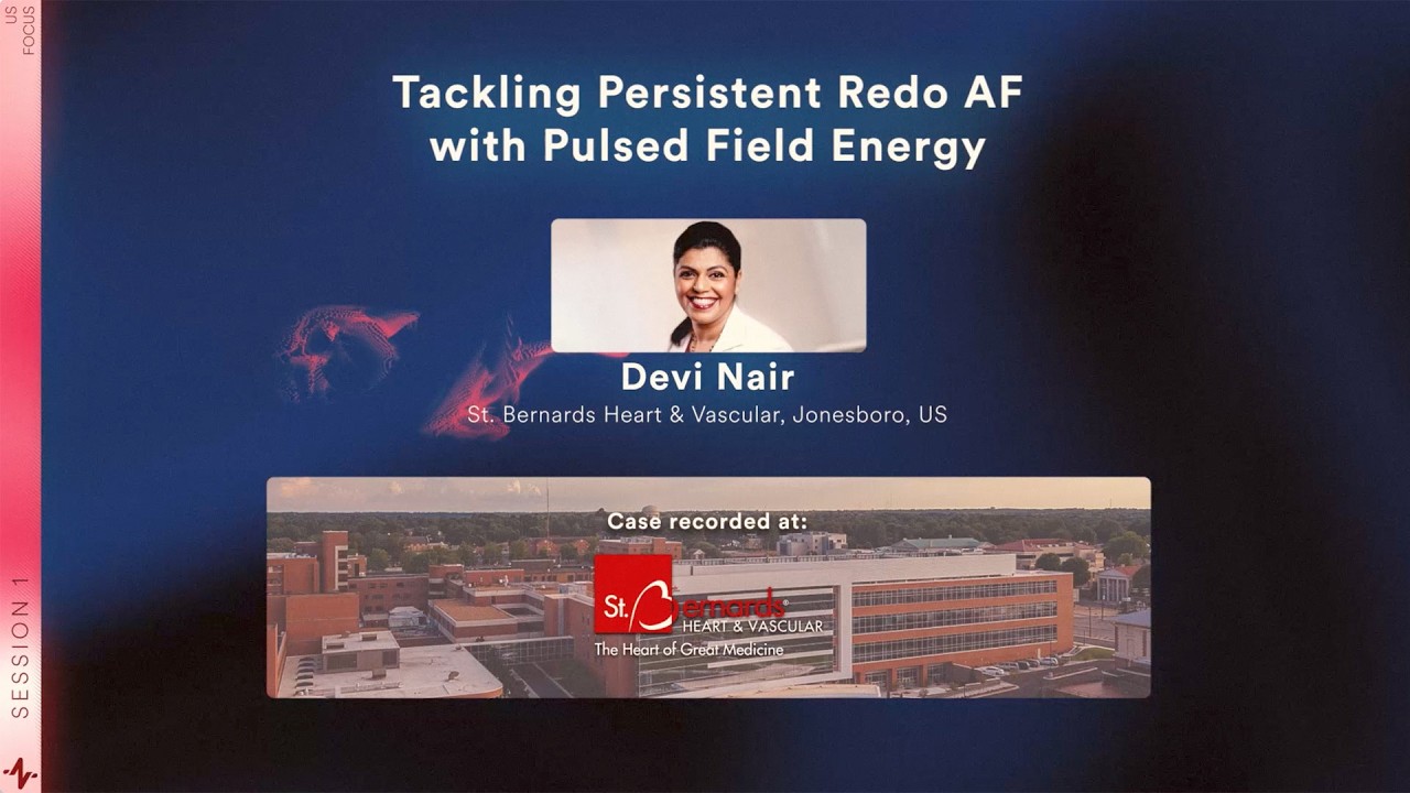 Case & Discussion: Tackling Persistent Redo AF with Pulse Field Energy | RIO 2025 US Focus