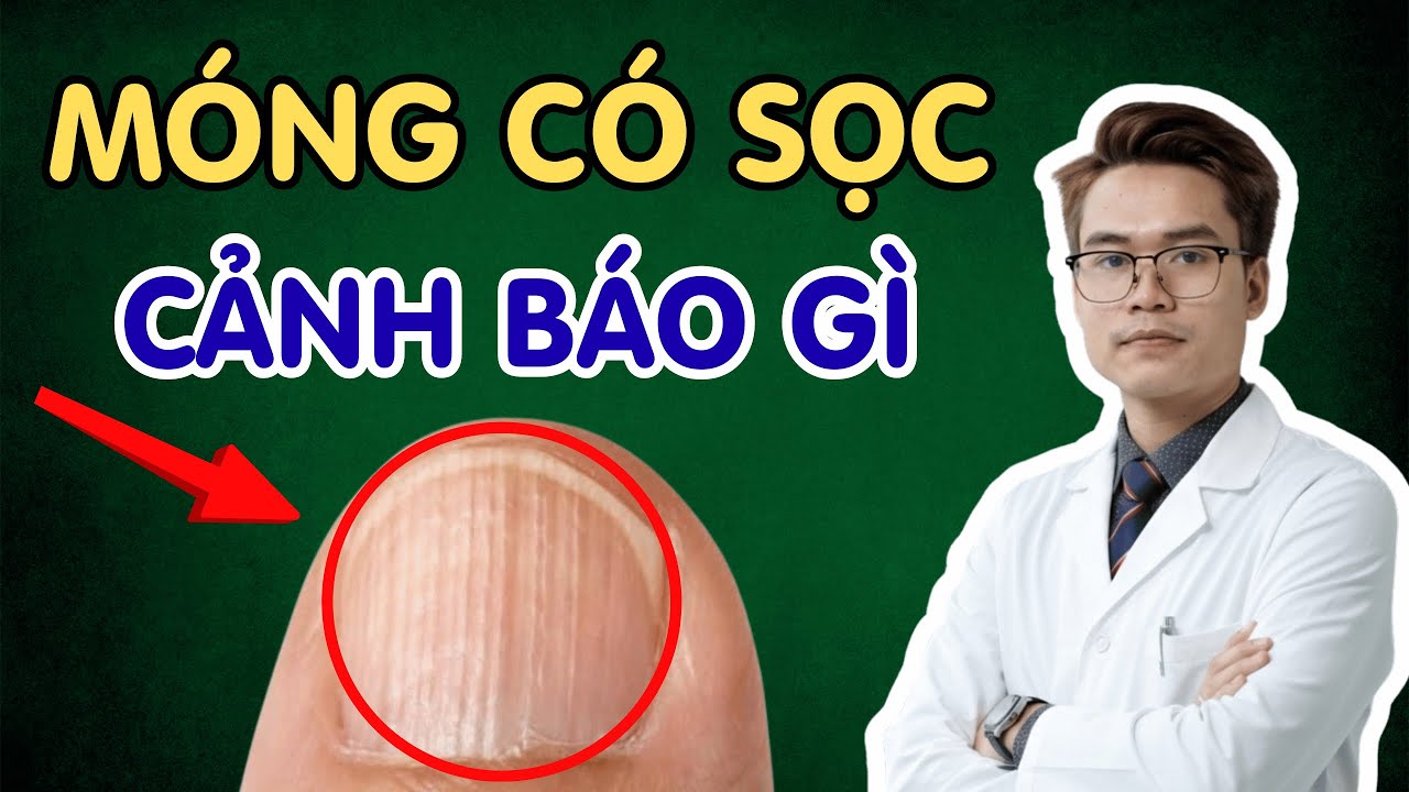 Tại Sao Móng Tay Bạn Lại Có Gờ Dọc? Nguyên Nhân và Giải Pháp Cải Thiện | Bs Phạm Tuấn