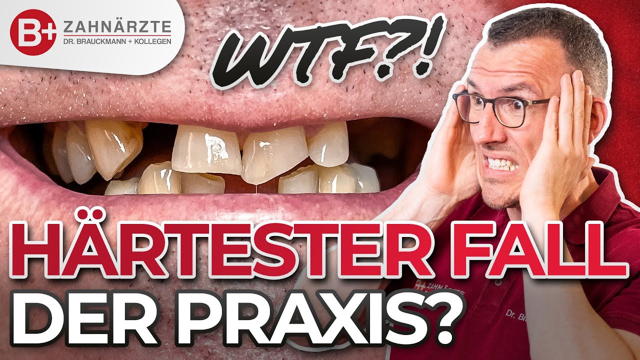 Krasser Patientenfall 🤯 Zahnarztangst überwunden! Kronen & Brücken für Oberkiefer und Unterkiefer