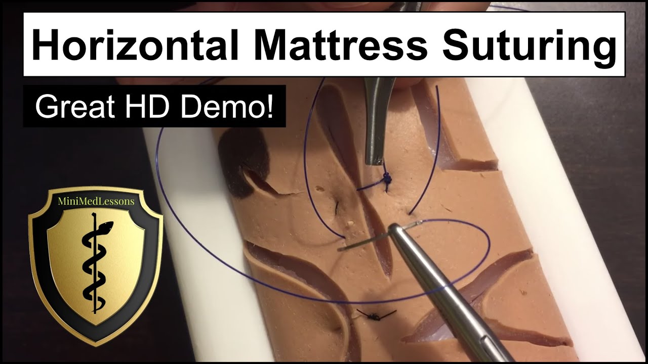Учебное пособие по наложению швов: техника горизонтального матрасного шва — пошаговая инструкция ...