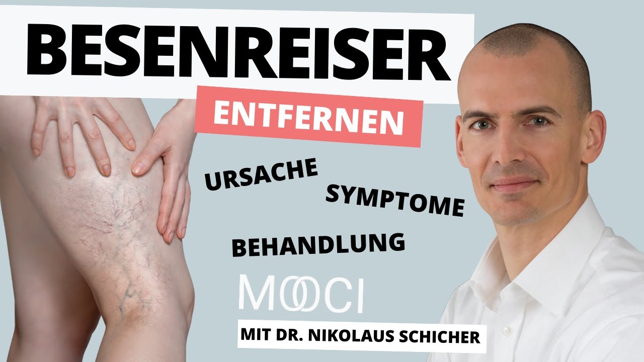 Besenreiser entfernen- Ursachen, Symptome, Behandlung!