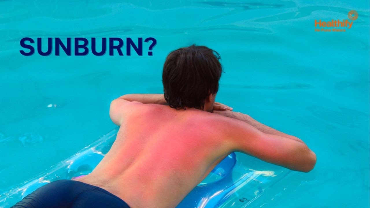 Sunburn isn’t just uncomfortable: here’s why it matters