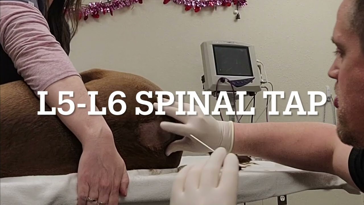 L5-L6 Spinal Tap