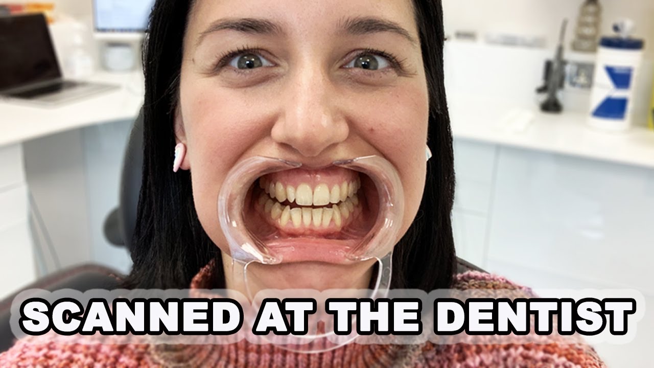 I have been scanned at the dentist!!! First Invisalign appointment, what to expect - Sara Manfredda