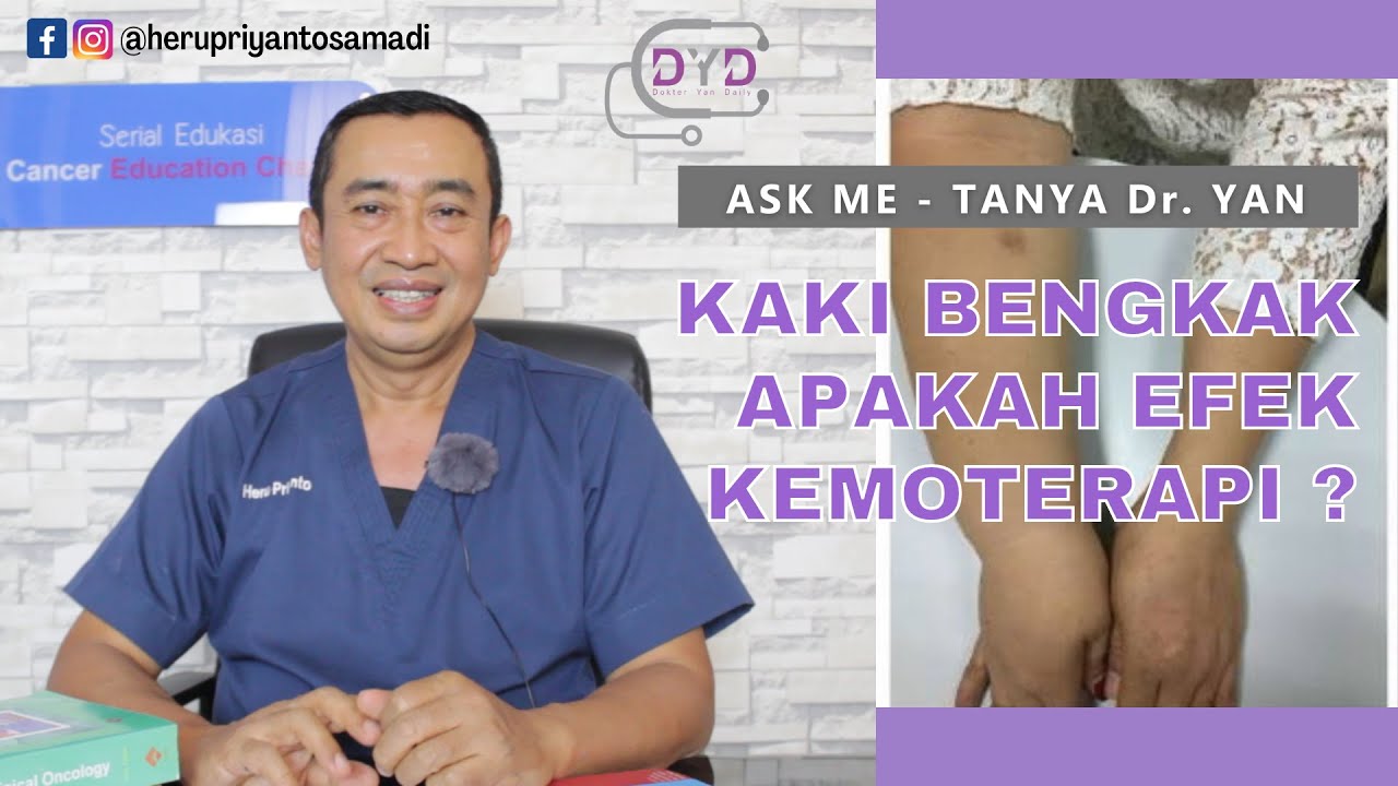 Ask Me - Tanya Dr. Yan | Kaki Bengkak Apakah Efek Kemoterapi?